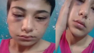 محامي عن اغتصاب منة عبد العزيز: جريمة ولو برضاها كونها قاصرا