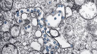 دراسة تكشف متى يتوقف مرضى 