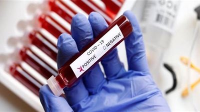 لجنة من صحة الإسماعيلية تتوجه لمنطقة المنايف عقب ظهور حالات كورونا بها