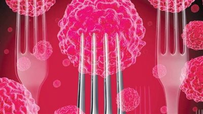 احذر.. 5 أطعمة وعادات غذائية تسبب السرطان