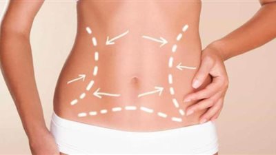 استشاري يشرح كيف يتم شد البطن بدون جراحة باستخدام طاقة البلازما الباردة