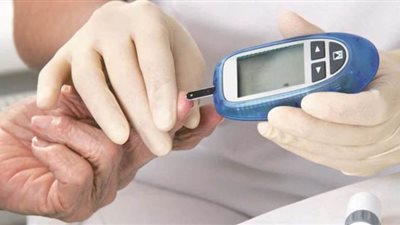 أستاذ جراحة أوعية دموية يوضح كيفية التعايش السلمي مع مرض السكري