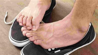 10 أمراض تكشفها قدميك عن صحتك