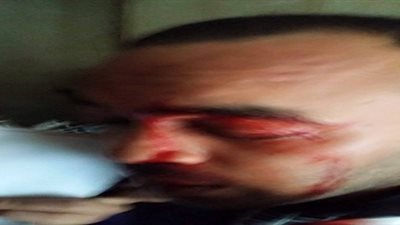 ننشر صور أحد محامي شبرا الخيمة المعتدى عليهم من قبل مجند شرطة