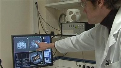 دواء لتجنب تأثيرات العلاج الكيميائى لمرضى السرطان