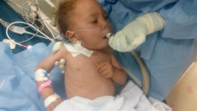 إنقاذ حياة طفل مصاب بكورونا داخل مستشفى الحجر الصحي بتمى الأمديد