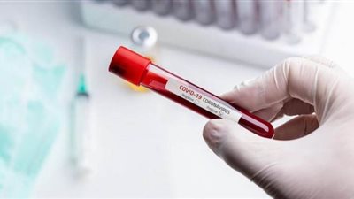 4 وفيات و710 إصابات جديدة بفيروس كورونا بـ