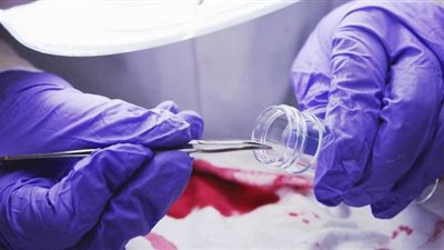 إرسال طالب مدينتي المتسب بمصرع سيدة للطب الشرعي لبيان مدى تعاطيه للمخدرات