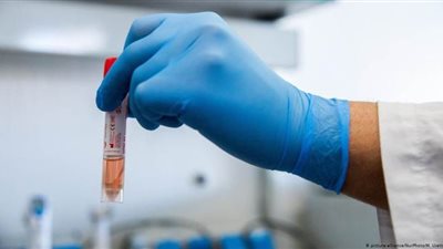 هل أصبح فيروس كورونا ضعيفا؟.. لجنة العلاج تجيب