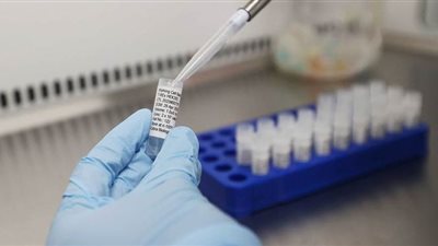 المصل واللقاح: بدء إنتاج أول لقاح مضاد لفيروس كورونا خلال شهرين