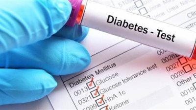 أهمية تحليل السكر التراكمي ومعدلاته الطبيعية في الدم
