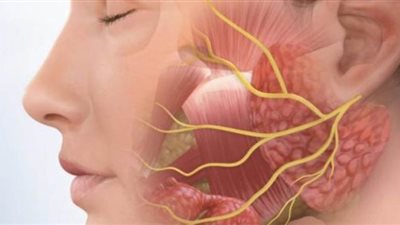 أعراض الإصابة بمرض العصب السابع وطرق العلاج