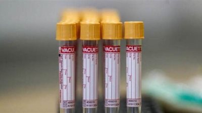 عضو بفريق أوكسفورد: نتائج لقاح كورونا الجديد تظهر آخر يوليو