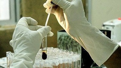 تطوير تحليل دم للكشف المبكر عن مرض السكر 