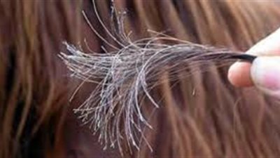 تعرفي على أسباب جفاف وتقصف الشعر وطرق العلاج