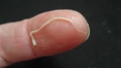 للأمهات احذري عدوى الديدان الخيطية عند طفلك