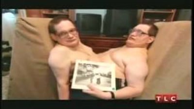 بالفيديو.. روني ودوني أكبر تواءم العالم المتصلين سنا