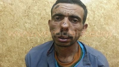 «جثث الموتى» في مزاد «طب» بني سويف.. القبض على «عامل» ينبش القبور لاستخراج الجماجم لبيعها للطلاب.. العامل: أبيع الجماجم لطلاب الكلية.. الجمجمة بـ250 والهيكل العظمي بـ1500