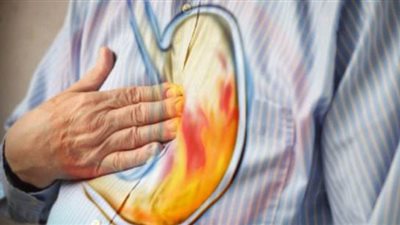 4 وصفات منزلية للتخلص من الحموضة دون الحاجة للأدوية