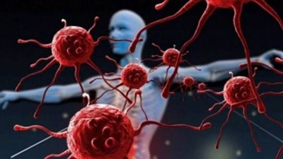 كيفية اكتشاف السرطان والسكري عن طريق الرائحة