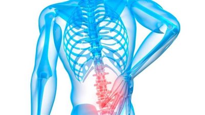 كل ما تود معرفته عن الانزلاق الغضروفي وأعراضه وعلاجه