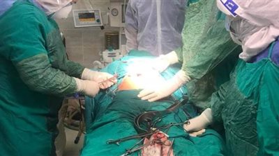 إجراء عملية نادرة لمصابة بفيروس كورونا بمستشفى الأقصر العام للعزل