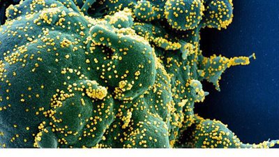 الإمارات تعلن عن علاج أكثر من 2000 مريض بفيروس كورونا بالخلايا الجذعية