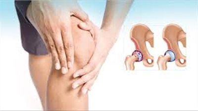 3 مشروبات عشبية تخلصك من آلام المفاصل