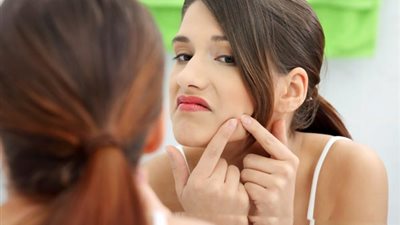 أفضل 4 مواد طبيعية تخلصك من حب الشباب نهائيا