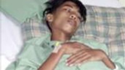 بالصور.. آلام المعدة تكشف حمل صبي في توءمه