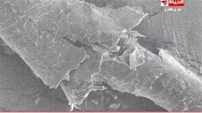 بالفيديو.. خبير تجميل: درجات الحرارة المرتفعة تؤدي إلى تقصف الشعر