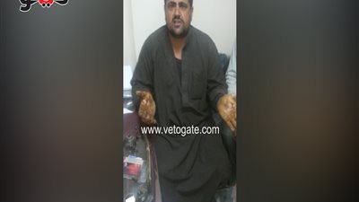 بالفيديو.. شكوى مزارعى الشرقية من الأسمدة الفاسدة