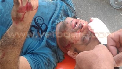 شاب سقط أسفل «مترو السادات» لـ«المسئولين»: «إنتوا اللي زحلقتوني»