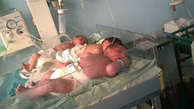 106 آلاف جنيه لترميم الحضانات بمستشفى الإسماعيلية العام