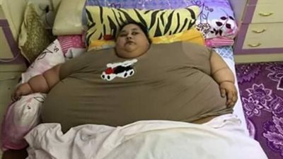 بالصور.. خلل في الهرمونات يتسبب في شل حركة فتاة بالإسكندرية.. 500 كيلو زيادة في وزن «إيمان».. لم تخرج من غرفتها منذ 25 سنة.. لجنة من «الصحة» تعاين الحالة.. والمريضة تناشد الرئيس با