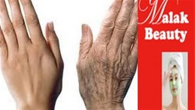 بالفيديو.. علاج نهائي من الطبيعة للتخلص من تجاعيد اليدين