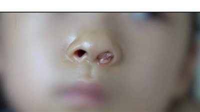 أطباء يكتشفون 