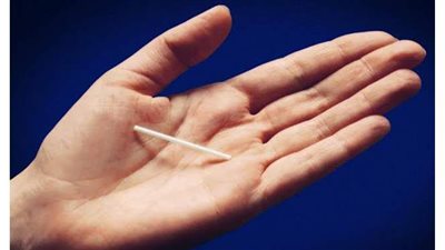 الصحة توفر كبسولة منع الحمل لمدة ٣ سنوات بـ 5 جنيهات