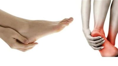 طريقة علاج انسداد شرايين الساق وكيفية حدوثه