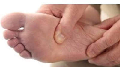 أشهر مضاعفات الإصابة بالقدم السكرية