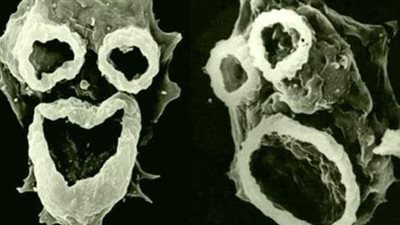 بعد كورونا والطاعون الدبلي.. 