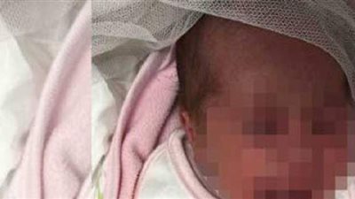 حكاية طفلة رضيعة نهشت الكلاب جسدها بالشرقية