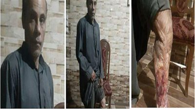 رئيس الوزراء يكلف بعلاج سائق 