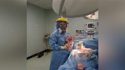 ولادة قيصرية وإنقاذ ذراع مريض من البتر لمصابي كورونا في 