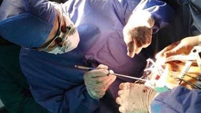 إنقاذ حياة أم وجنينها بعملية قلب مفتوح طارئة بمستشفى جامعة أسيوط