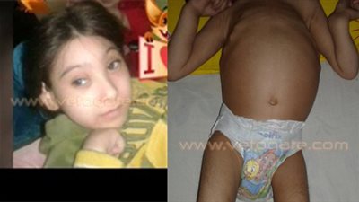 رسالة مبكية لإنقاذ «رضوى» من الموت.. الطفلة مصابة بشلل رباعي وعظم زجاجي واستئصال جزء من المخ.. والدتها: الأطباء عجزوا عن تشخيص الحالة.. ابنتي ليست أقل شأنا من «طفل إيطاليا».. ونستغ