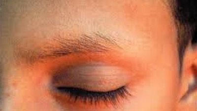 5 أسباب وراء تساقط شعر الحواجب