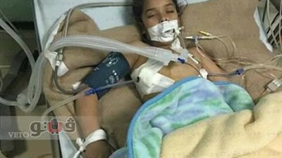 أسرة طفلة الشرقية «فرح» تطالب بتشريح جثتها