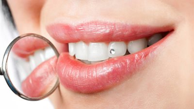 احصلي على أسنان بـ«بياض الثلج» بواسطة خلطات فيتامين