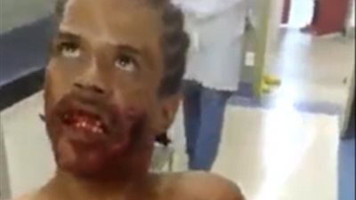 بالفيديو والصور.. رجل ممسوس يثير رعب موظفي مستشفى